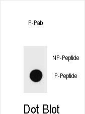 DB - Phospho-KIT(S821) Antibody AP3784c